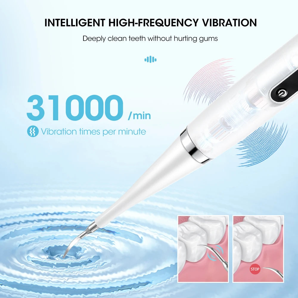 Electric Teeth Whitening Dental Calculus Scaler